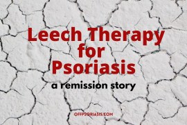 Psoriasis Remission with Medicinal Leeches
