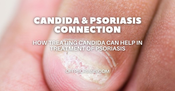 Could Candida Be Worsening Your Psoriasis Symptoms – Offpsoriasis