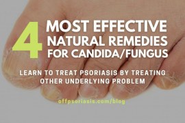 4 Most Effective Natural Remedies that treat Candida and not only…